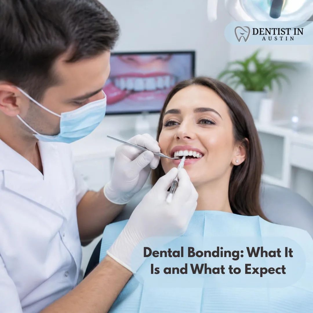 Dental Bonding: What It Is and What to Expect