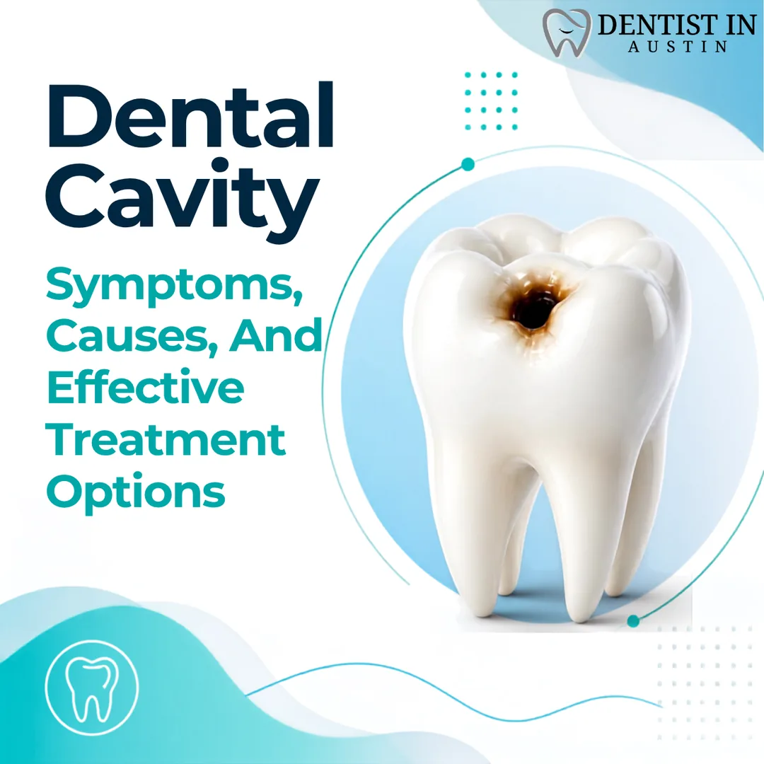 Dental Cavity Symptoms, Causes, And Effective Treatment Options