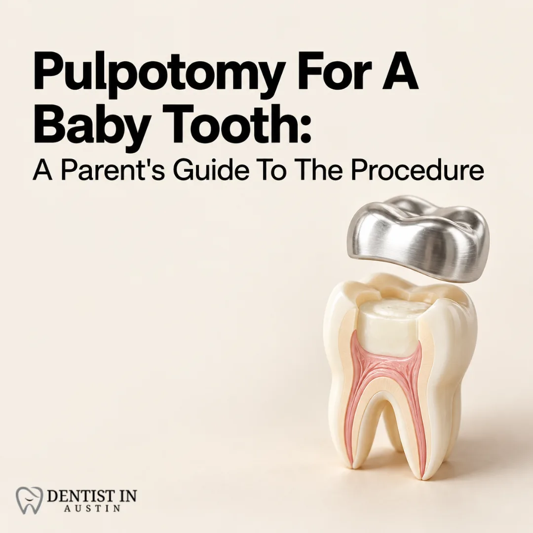 Pulpotomy For A Baby Tooth: A Parent's Guide To The Procedure