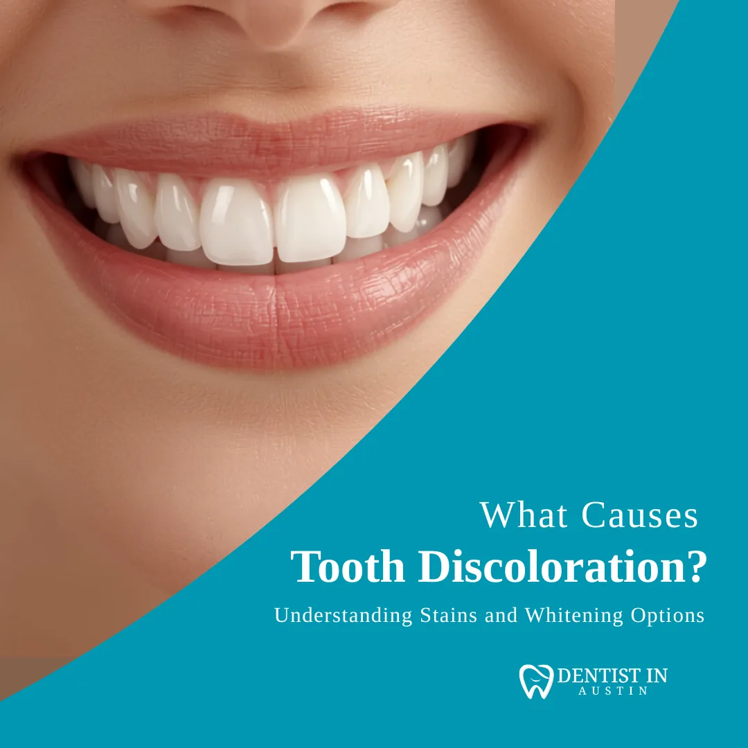 What Causes Tooth Discoloration? Understanding Stains and Whitening Options