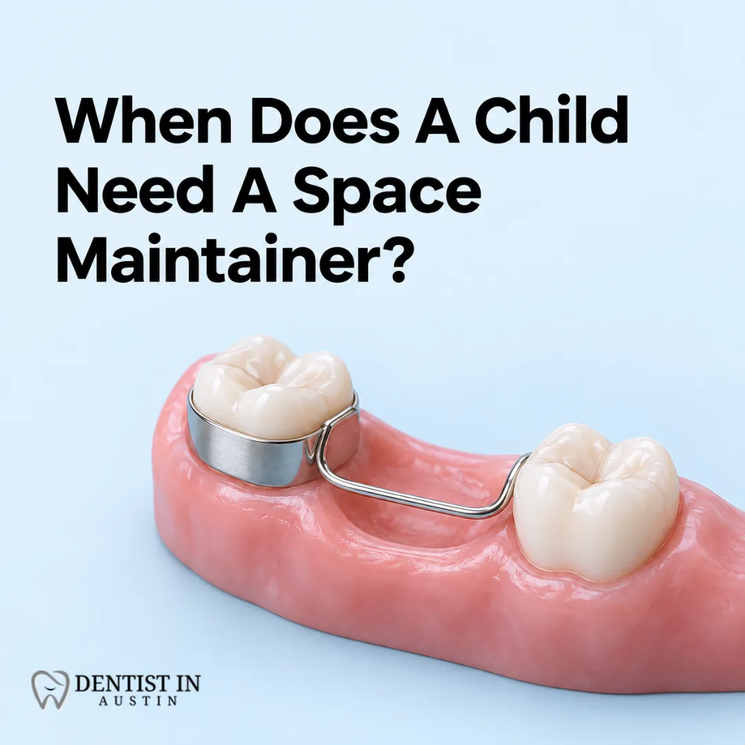 When Does A Child Need A Space Maintainer?